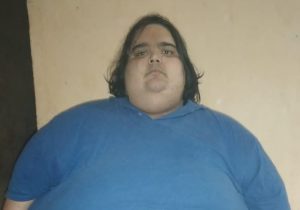 Com quadro de obesidade mórbida, jovem de São Vicente aguarda na fila da cirurgia bariátrica