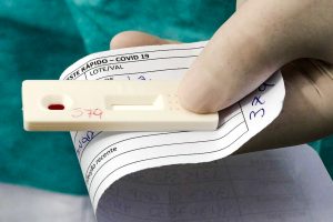 Teste de antígeno é o ideal para saber se está transmitindo a covid, diz infectologista