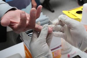Santos terá testagem de hepatite C no Quebra-Mar