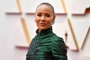 Alopecia, a doença de Jada Pinkett Smith, pode ter fundo emocional e afetar qualquer pessoa