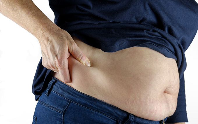 Acúmulo de gordura pode gerar fraturas no quadril | Jornal da Orla