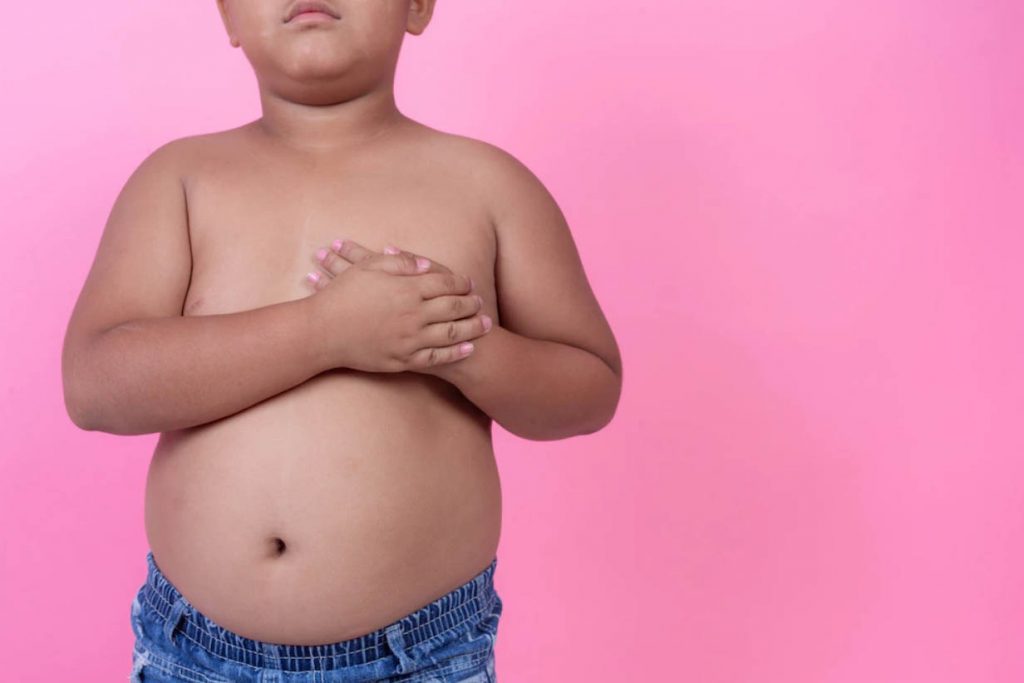 Alimentos ultraprocessados aumentam risco de obesidade infantil