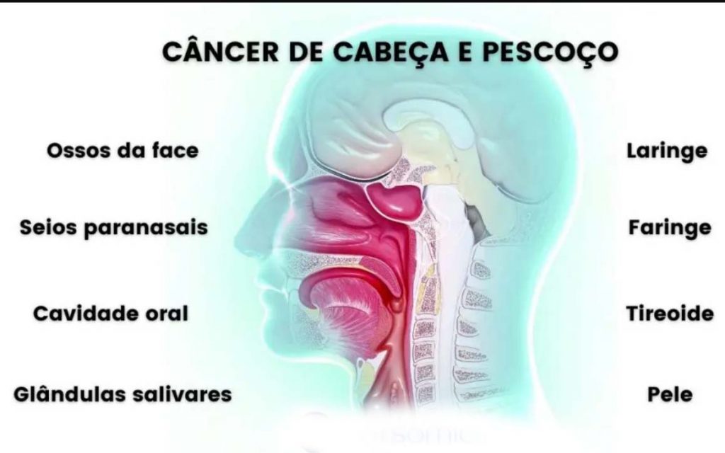 cancer cabeça e pescoço