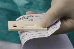 São Vicente amplia horário para testagem de Covid-19 nas unidades de saúde