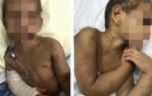 Garoto tem costelas quebradas após ser espancado por fazer bagunça