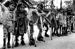 Paralisia infantil volta a ameaçar brasileiros