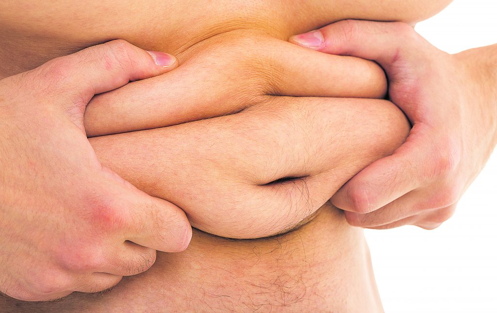 Cirurgia bariátrica só deve ser feita em casos extremos