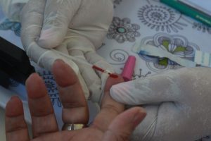 Onde fazer teste de hepatite em Santos