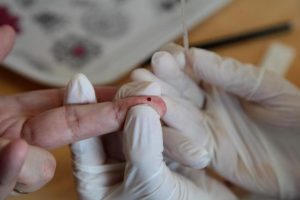 Julho Amarelo: Santos alerta para hepatites virais