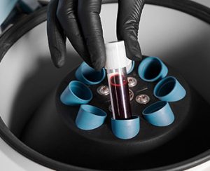 Entenda alguns exames laboratoriais