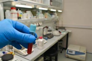 Exames de sangue regulares na saúde do coração