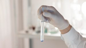Futuro dos exames laboratoriais com o uso da Inteligência Artificial