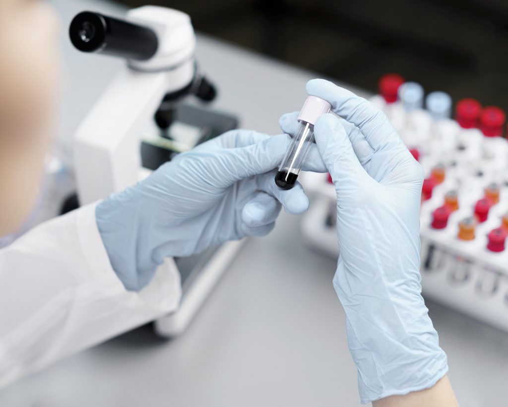 Pós Bariátrica x Exames Laboratoriais