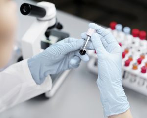 Pós Bariátrica x Exames Laboratoriais