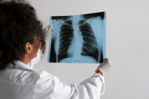 São Vicente amplia tratamento contra a tuberculose