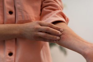 30% dos brasileiros convivem com algum tipo de alergia