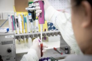 Estado descarta ação do Ebola em paciente internado em SP