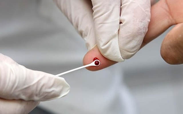 Campanha Fique Sabendo intensifica testagem de HIV e Sífilis | Jornal da Orla