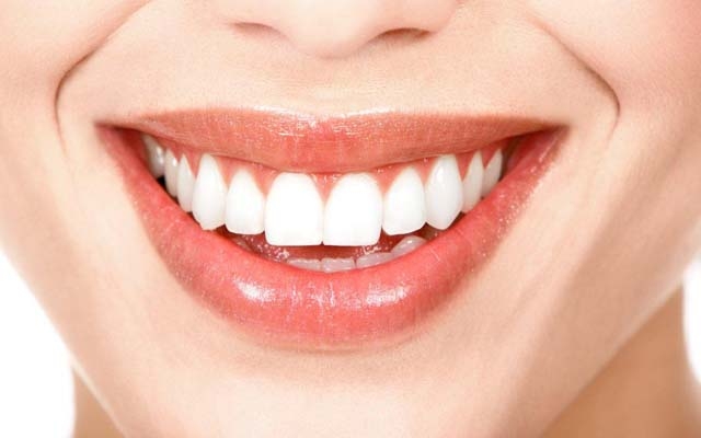 Saiba mais sobre o clareamento dentário | Jornal da Orla