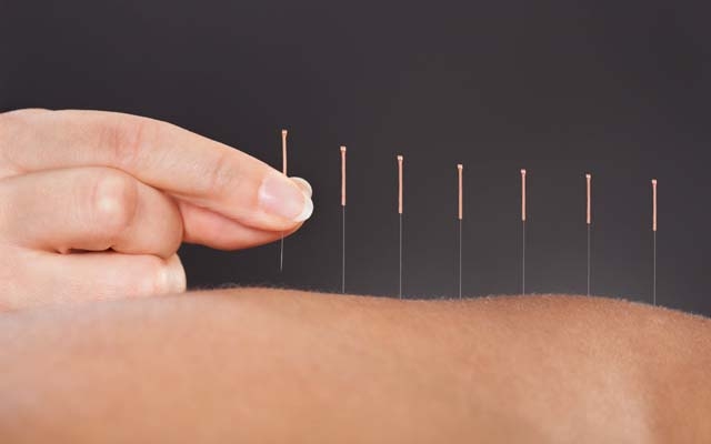 Acupuntura trata cólicas menstruais, TPM e previne a saúde da mulher
