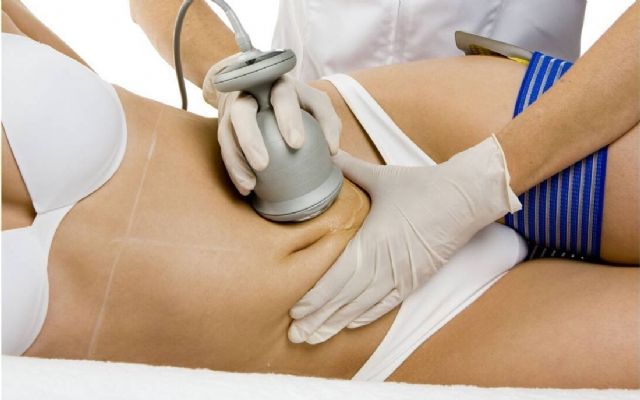 Lipocavitação para gordura localizada