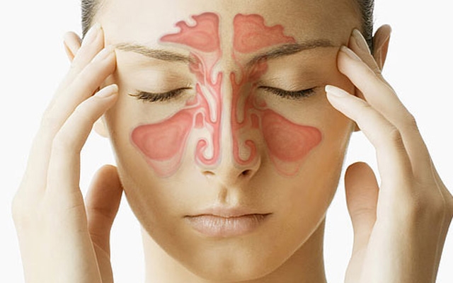 Sinusite pode ser prevenida | Jornal da Orla