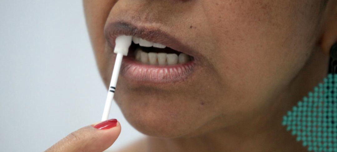 Policlínicas realizam teste rápido de HIV com saliva