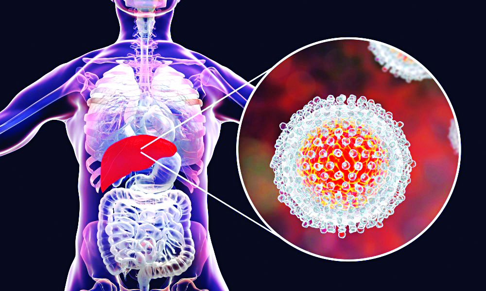 Brasil busca controle dos casos de Hepatite C