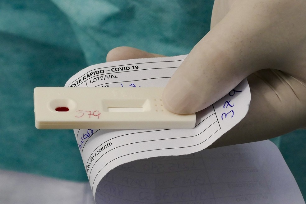 Laboratório oferece testes de Covid-19 em ação social