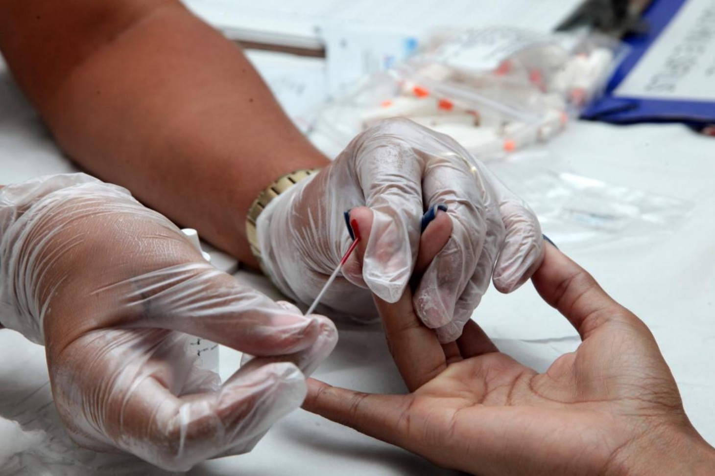 Policlínica de Santos realiza testes rápidos de HIV e Sífilis