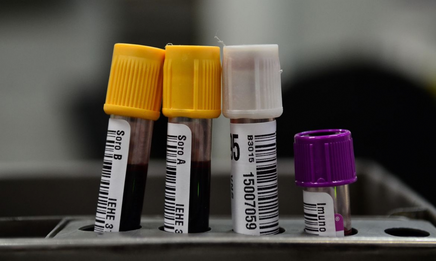 Iniciados testes com plasma sanguíneo no tratamento de covid-19 | Jornal da Orla