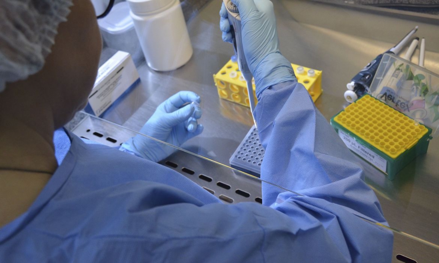 Pesquisadores desenvolvem teste para novo coronavírus com resultado imediato | Jornal da Orla