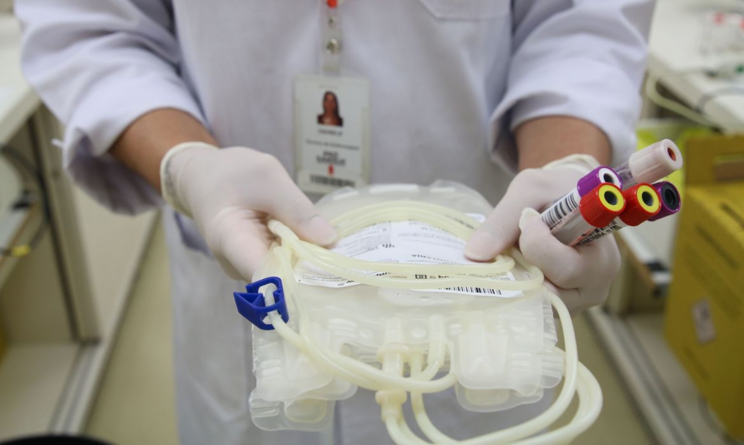 Número de doações de medula óssea cai 30chr37 devido à pandemia | Jornal da Orla