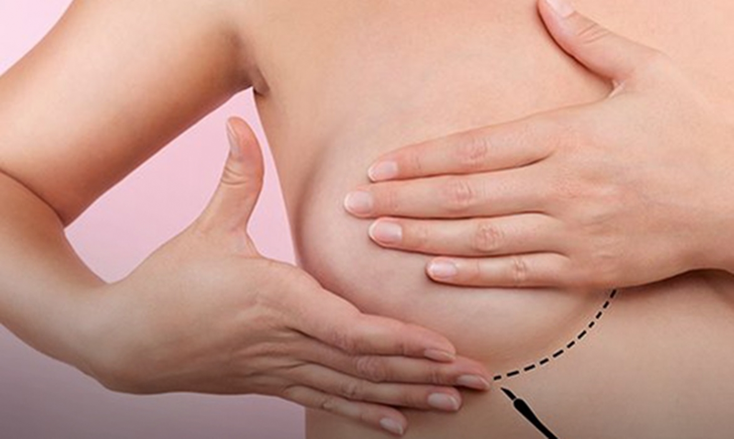 Câncer de mama supera o de pulmão e se torna o mais comum | Jornal da Orla