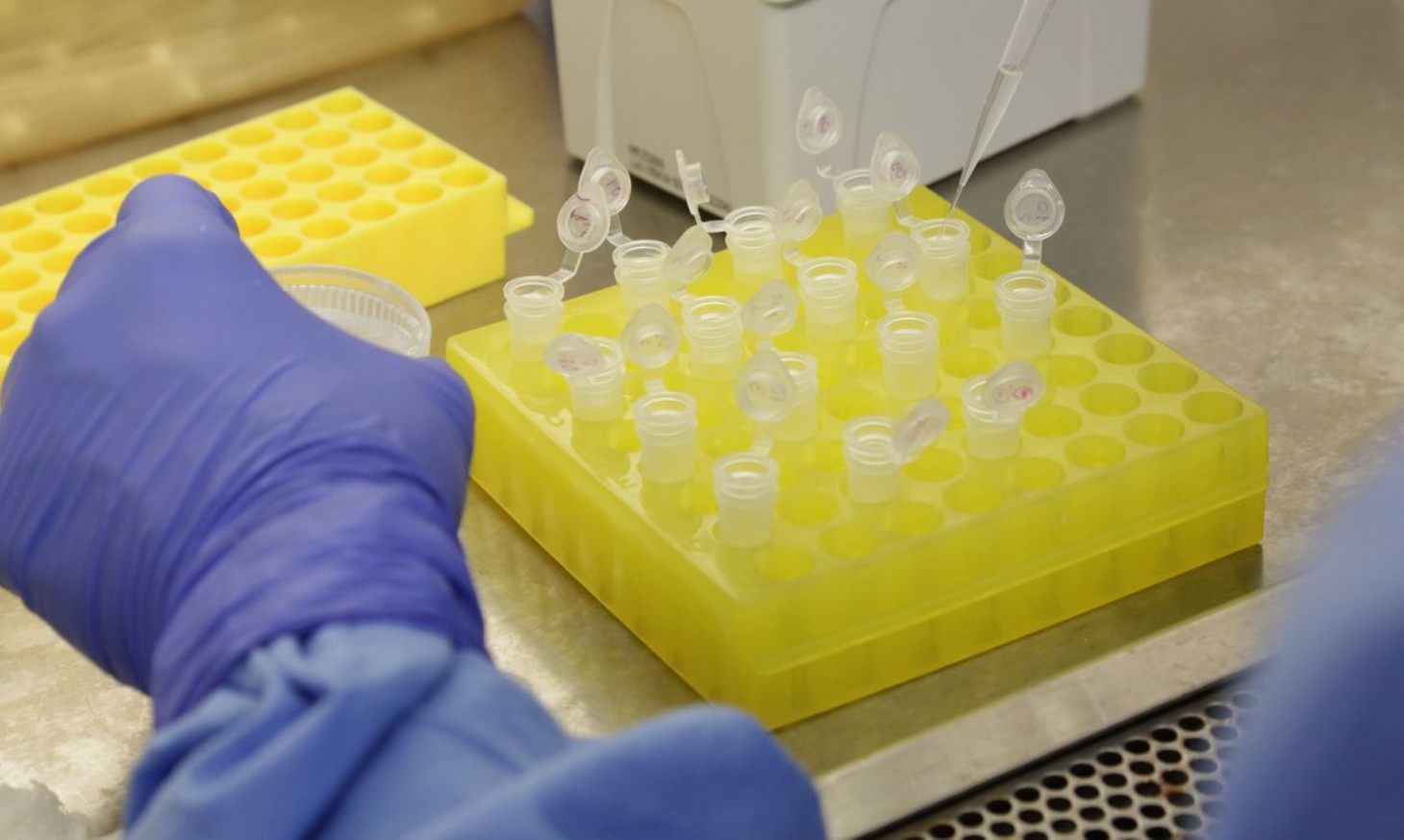 Testes para vacina contra HIV têm resultados promissores | Jornal da Orla