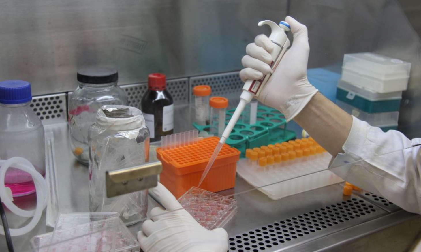 Pesquisadores desenvolvem testes rápidos para diagnóstico de covid-19 | Jornal da Orla